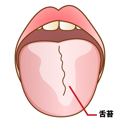 舌苔について